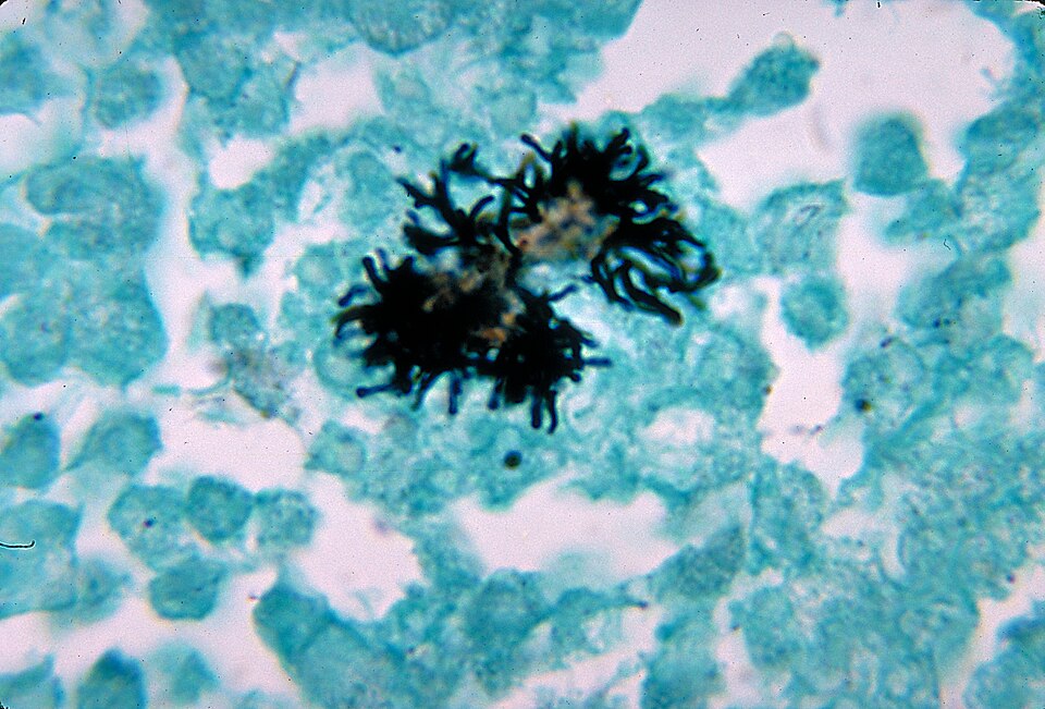 Actinomyces