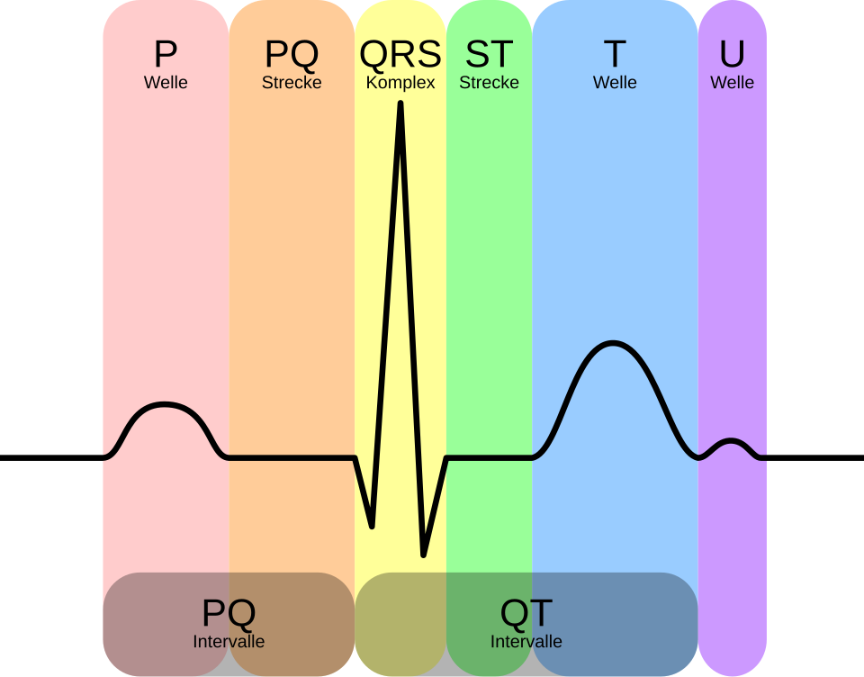 EKG-Intervalle