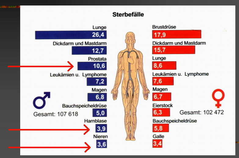 Mortalitt urologischer Tumore